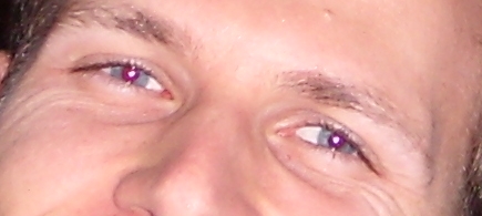rote_augen_2.jpg
