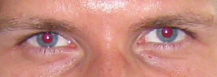 rote_augen_1.jpg