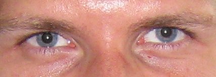 rote_augen_1_2.jpg