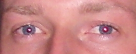 rote_augen_4.jpg